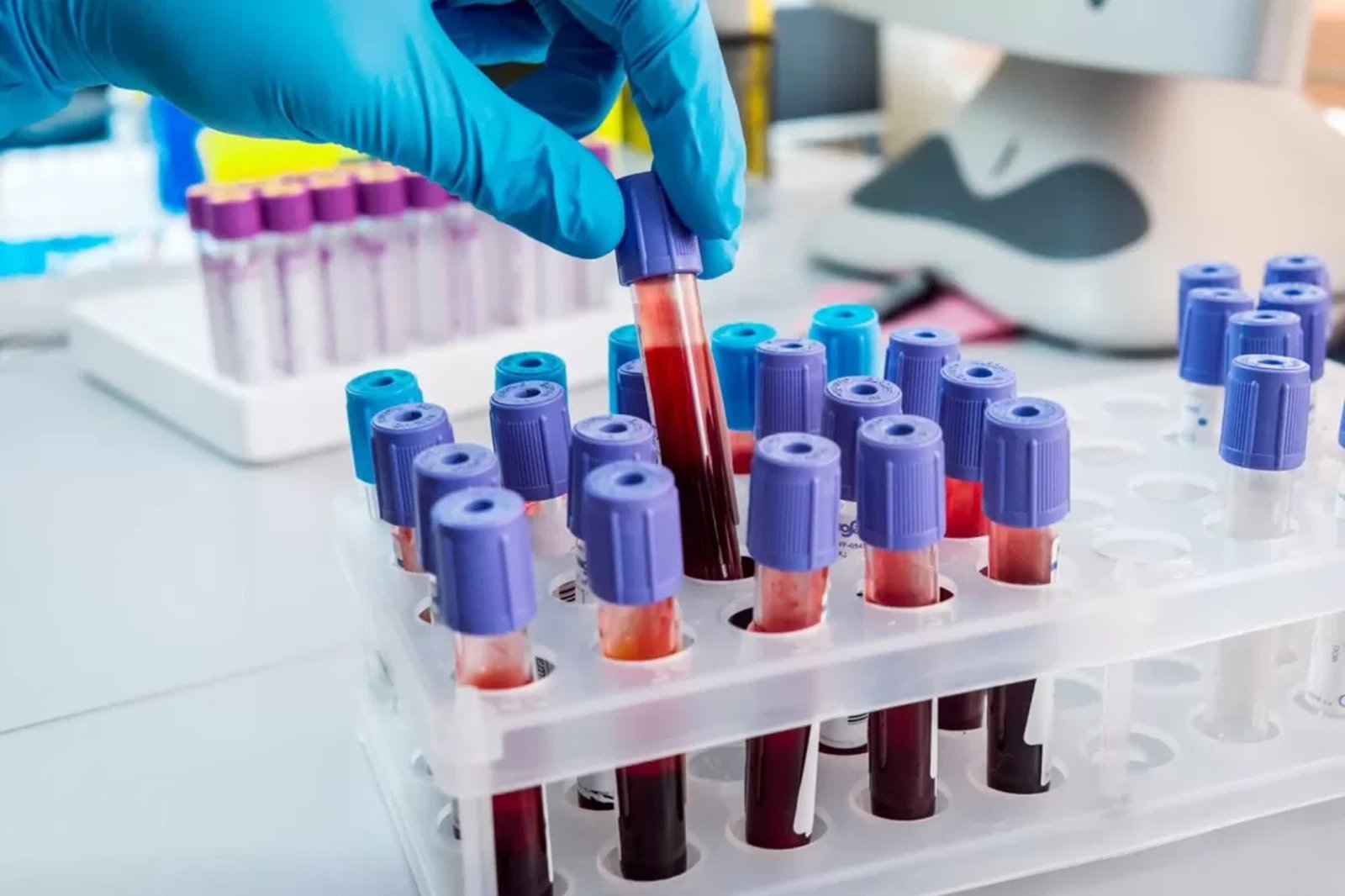 Easy blood test can predict a woman