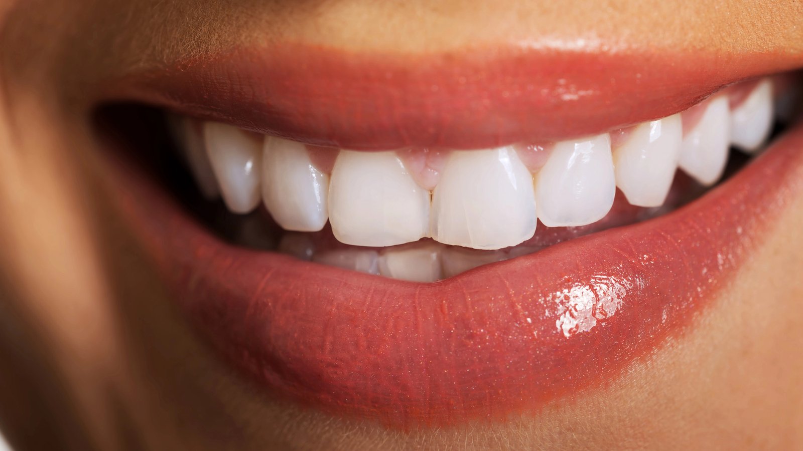 Close up on woman white teeth.